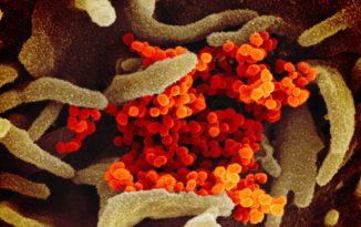 Naturally Immune People at Little Risk of Reinfection, Severe Disease From COVID-19: Study